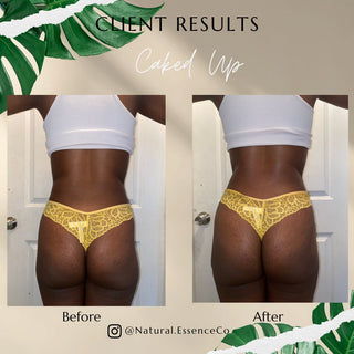 Caked Up (Booty & Hip Enhancement)